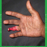 Hand Safety